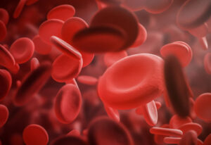 Thalassemia and Chelation Therapy
