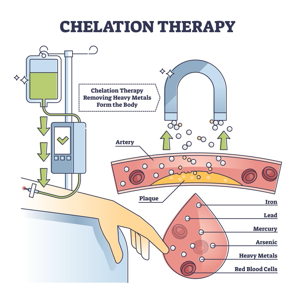 Chelation therapy diagram